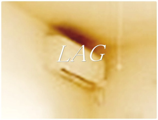 【設備】 | サニーレジデンス | エアコンです。