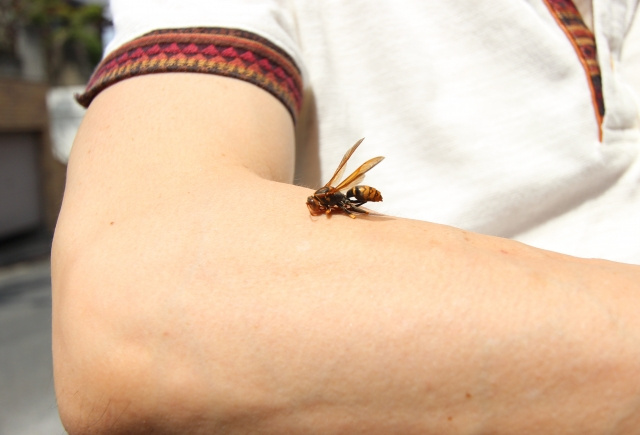 ハチに刺されると起こる症状とは？