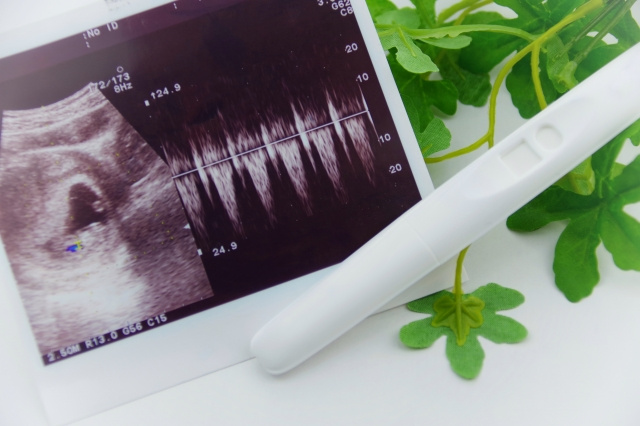 守口市で出産費用に困っている人が受けられる支援は助産制度！