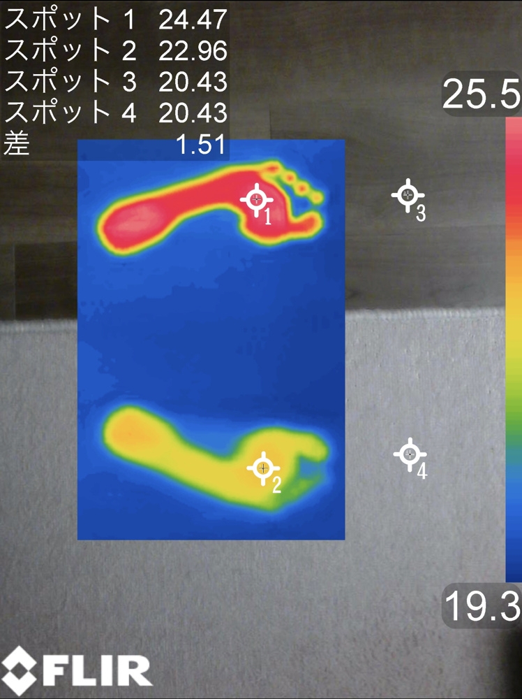 家が寒い時の対策、どうしてますか？の画像