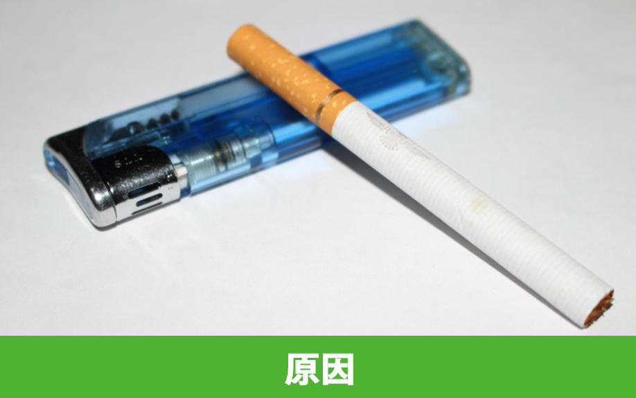 空き家で火災が起きる原因と種類