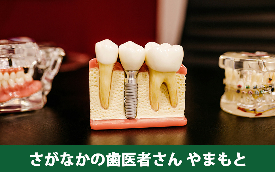 木津川市でおすすめの歯科医院「さがなかの歯医者さん やまもと」